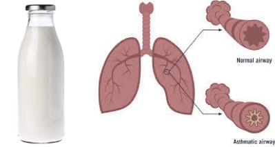 milk and asthma dairynews7x7
