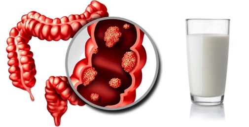 glass of milk cuts bowel cancer risk dairynews7x7