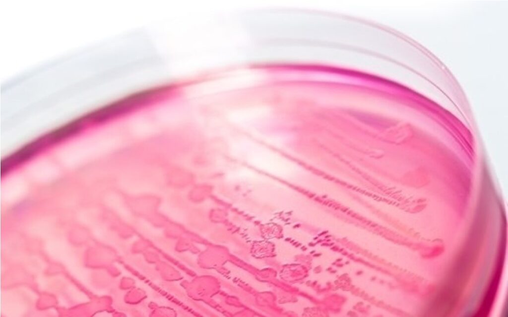 E coli contamination Egyptian dairynews7x7