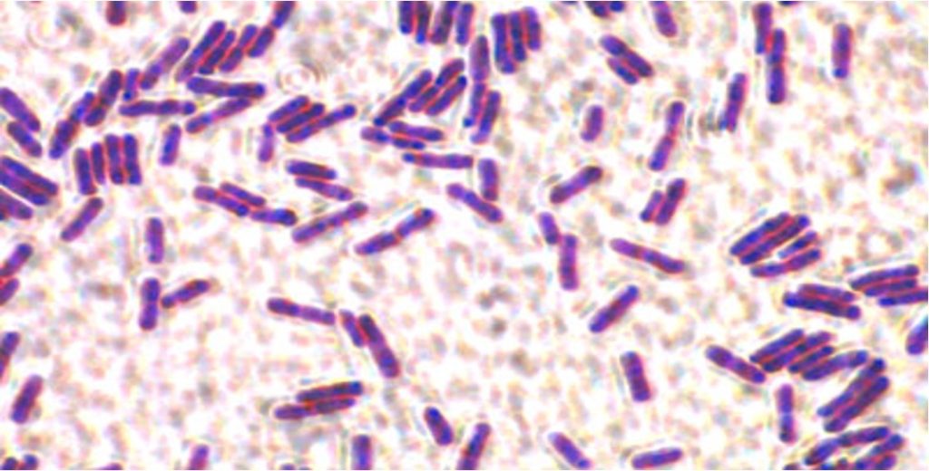 bacillus spores in milk dairynews7x7